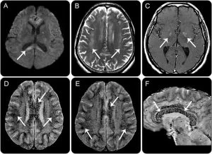 هم هوایی در کوهنوردی چیست؟ 11 varam maghz